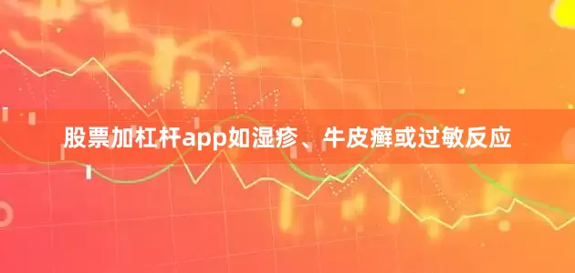 股票加杠杆app如湿疹、牛皮癣或过敏反应